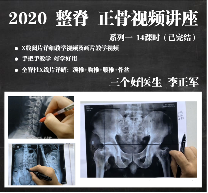 2020三个好医生李正军全脊柱X线颈胸腰读片高清视频教程【百度网盘下载】