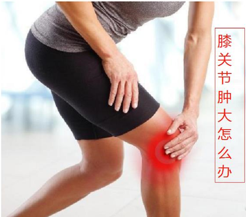 【健康知识】膝关节肿大怎么处理呢？滑膜炎的常见处理方法-正骨教程博客