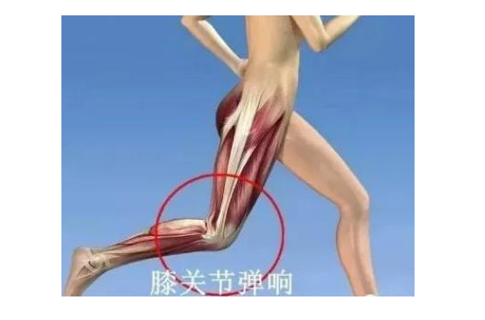 图片[1]-【健康知识】膝关节“弹响”，可能是这8大问题导致的，值得注意！